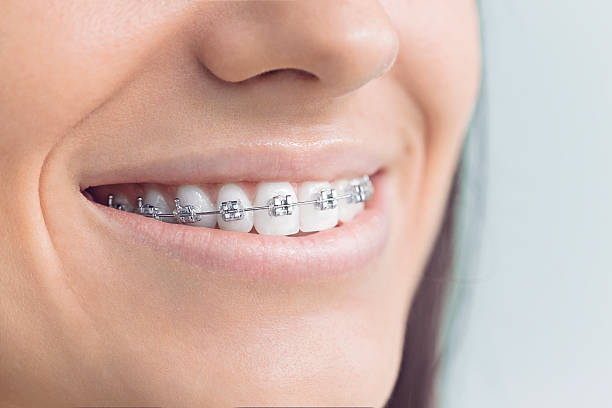 Best Veneers and Lumineers  in Laughlin Af, TX